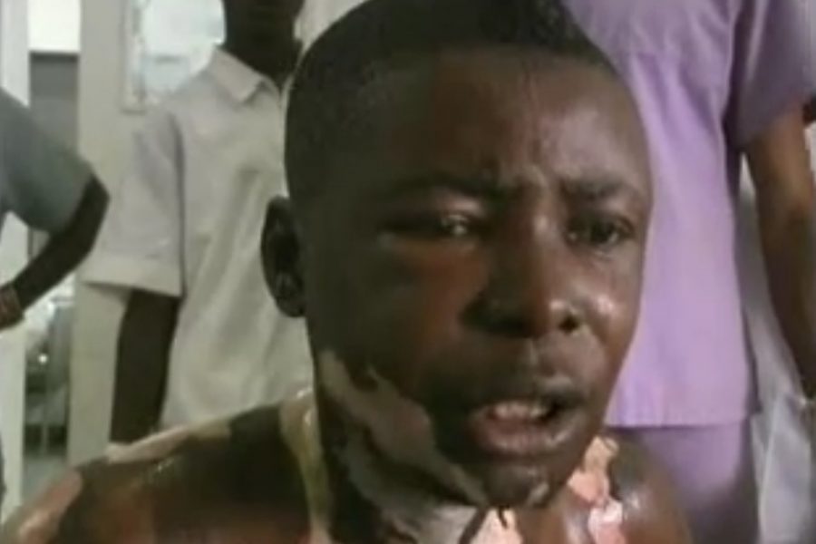 Cedrick Nianza, martyr de la nation congolaise meurt apres s’être s’immolé